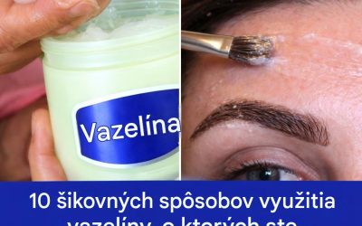 17 dôvodov, prečo by každá žena mala vlastniť fľaštičku vazelíny