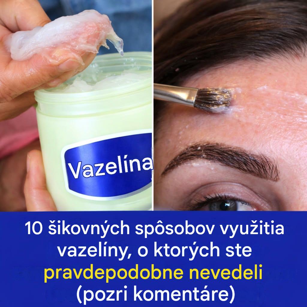 17 dôvodov, prečo by každá žena mala vlastniť fľaštičku vazelíny