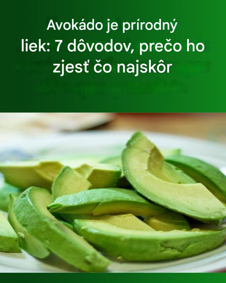 7 dôvodov, prečo jesť avokádo